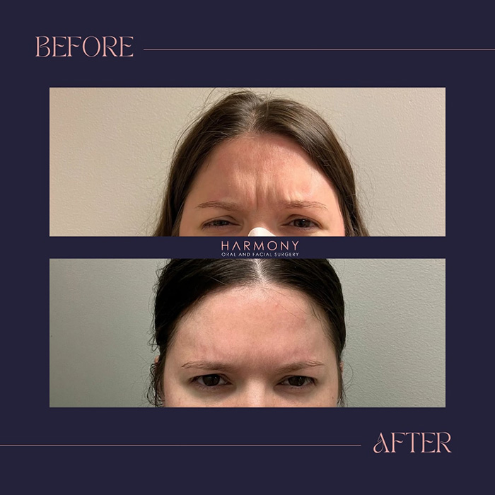 Harmony Oral   Facial Surgery | Replacing Missing Teeth, Ridge Augmentation and Bone Grafts