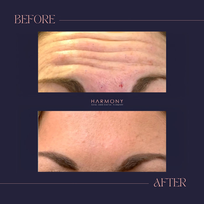 Harmony Oral   Facial Surgery | IV Sedation, Oral Pathology and Bone Grafts