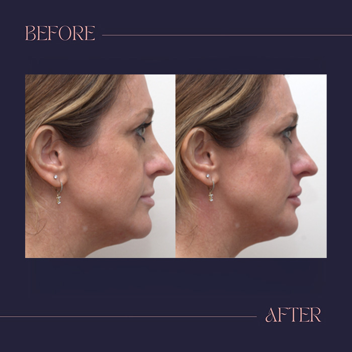 Harmony Oral   Facial Surgery | Nitrous Sedation, Fillers and Ridge Augmentation
