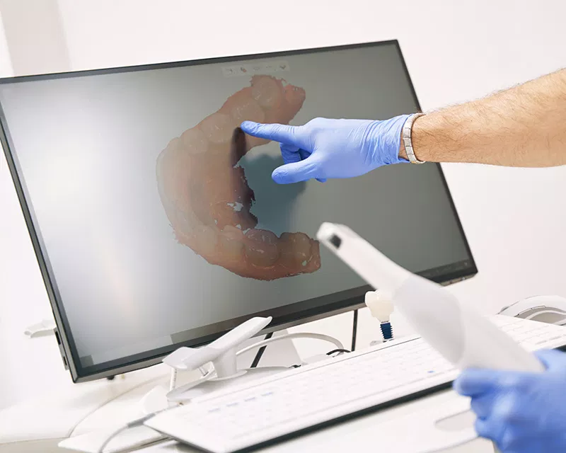 Harmony Oral Facial Surgery | Facial Trauma, PRF and Replacing Missing Teeth