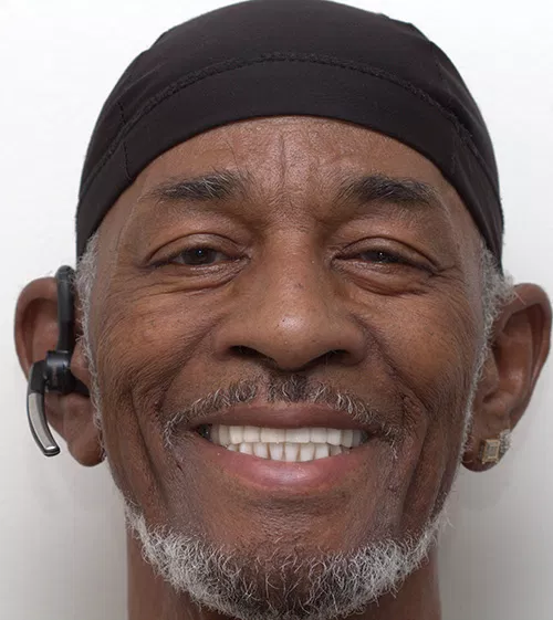 Harmony Oral Facial Surgery | Bone Grafts, Advanced Grafting for Thin Jaw and Oral Sedation