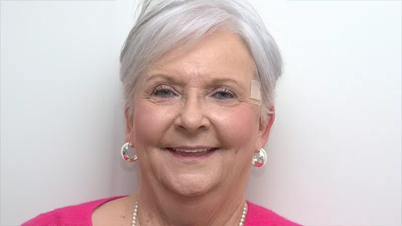 Harmony Oral Facial Surgery | Ridge Augmentation, Sedation and General Anesthesia