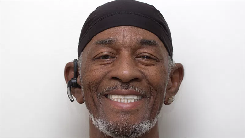 Harmony Oral Facial Surgery | Socket Preservation, Replacing Missing Teeth and Sinus Lift