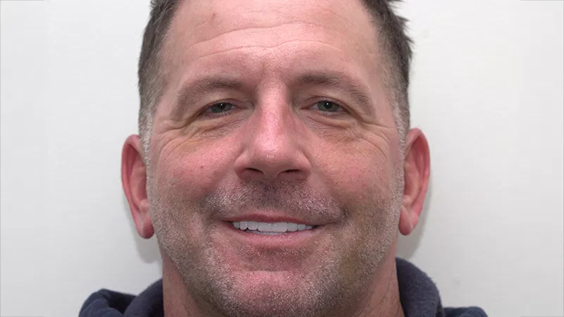 Harmony Oral Facial Surgery | Teeth in a Day, Nitrous Sedation and Oral Pathology