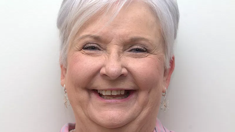 Harmony Oral Facial Surgery | Wisdom Teeth Extractions, Extractions and Ridge Augmentation