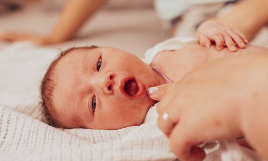 Infant being examined for tongue-tie by an oral and maxillofacial surgeon
