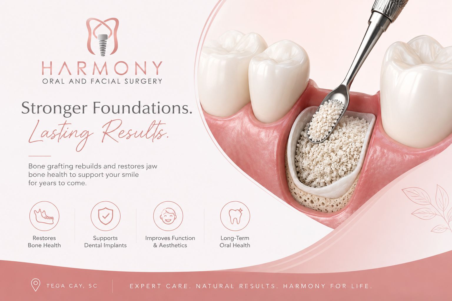 bone grafting at harmony